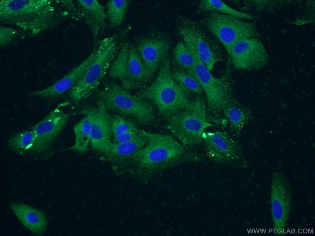 VPS18 Antibody in Immunocytochemistry (ICC/IF)