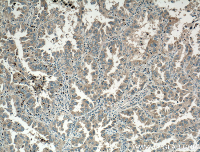 VPS18 Antibody in Immunohistochemistry (Paraffin) (IHC (P))