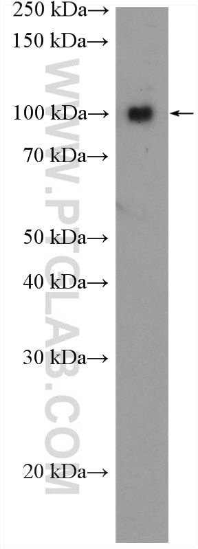 VPS18 Antibody in Western Blot (WB)