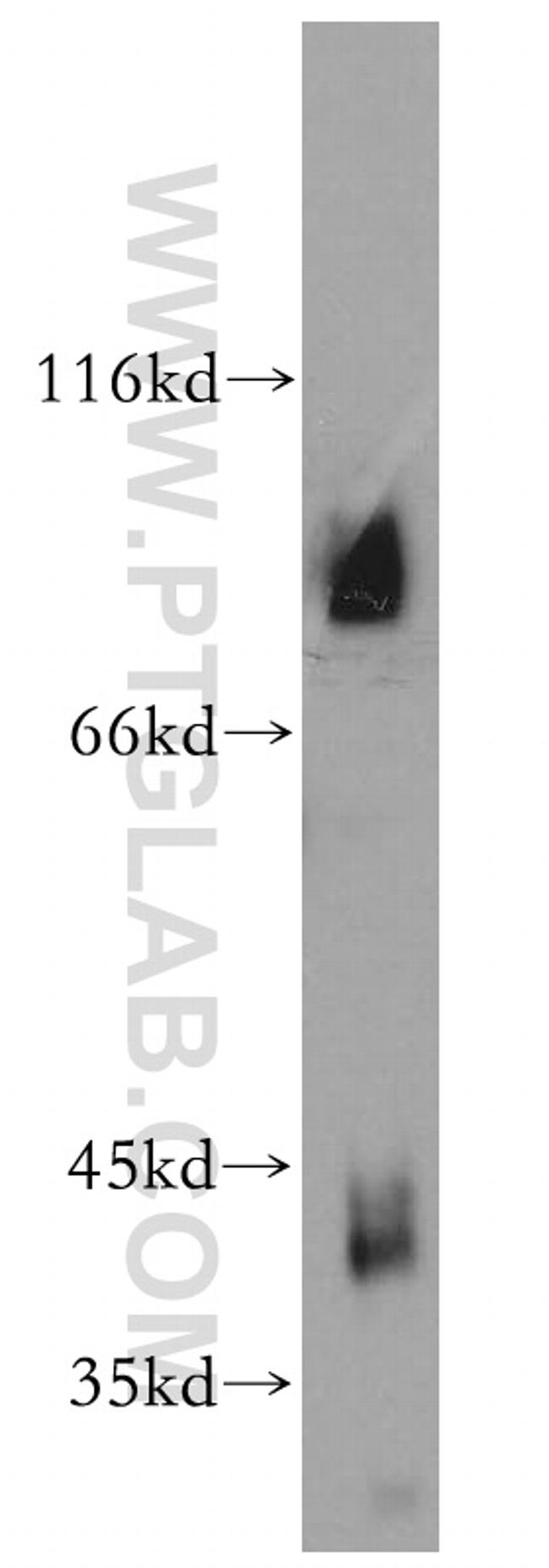 VPS18 Antibody in Western Blot (WB)