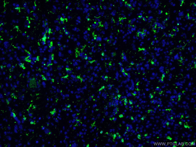 IBA1 Antibody in Immunohistochemistry (PFA fixed) (IHC (PFA))