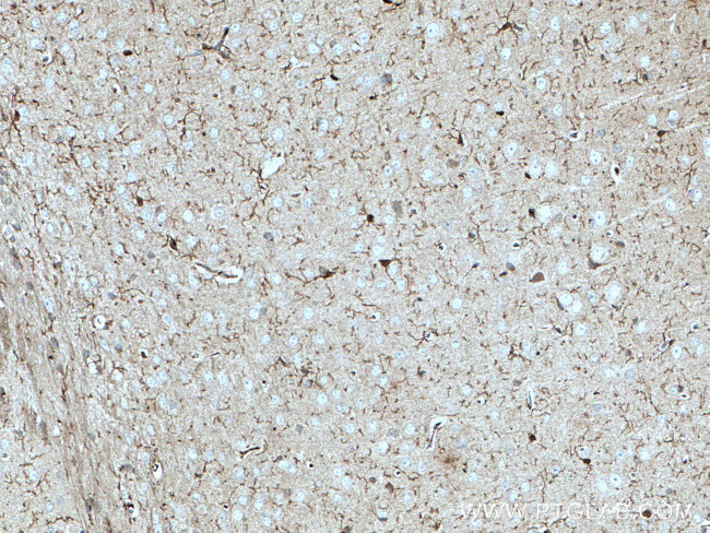 IBA1 Antibody in Immunohistochemistry (Paraffin) (IHC (P))