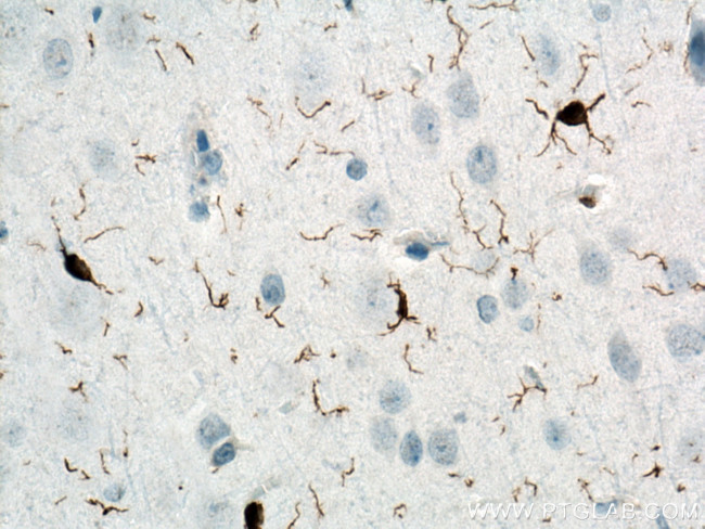 IBA1 Antibody in Immunohistochemistry (Paraffin) (IHC (P))