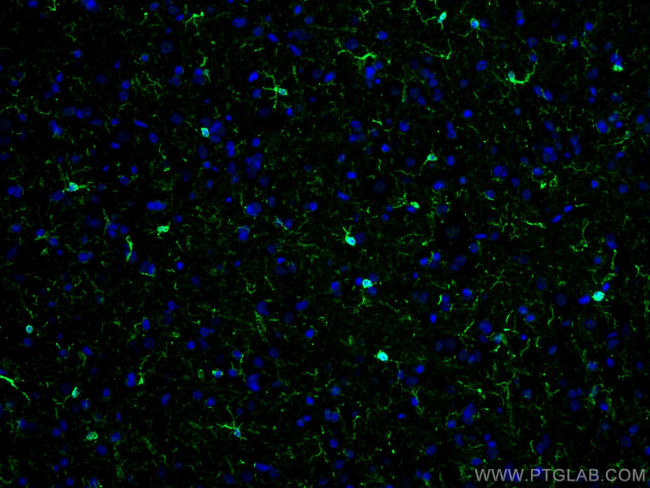 IBA1 Antibody in Immunohistochemistry (PFA fixed) (IHC (PFA))