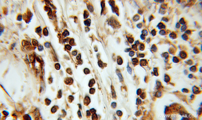 ING3 Antibody in Immunohistochemistry (Paraffin) (IHC (P))