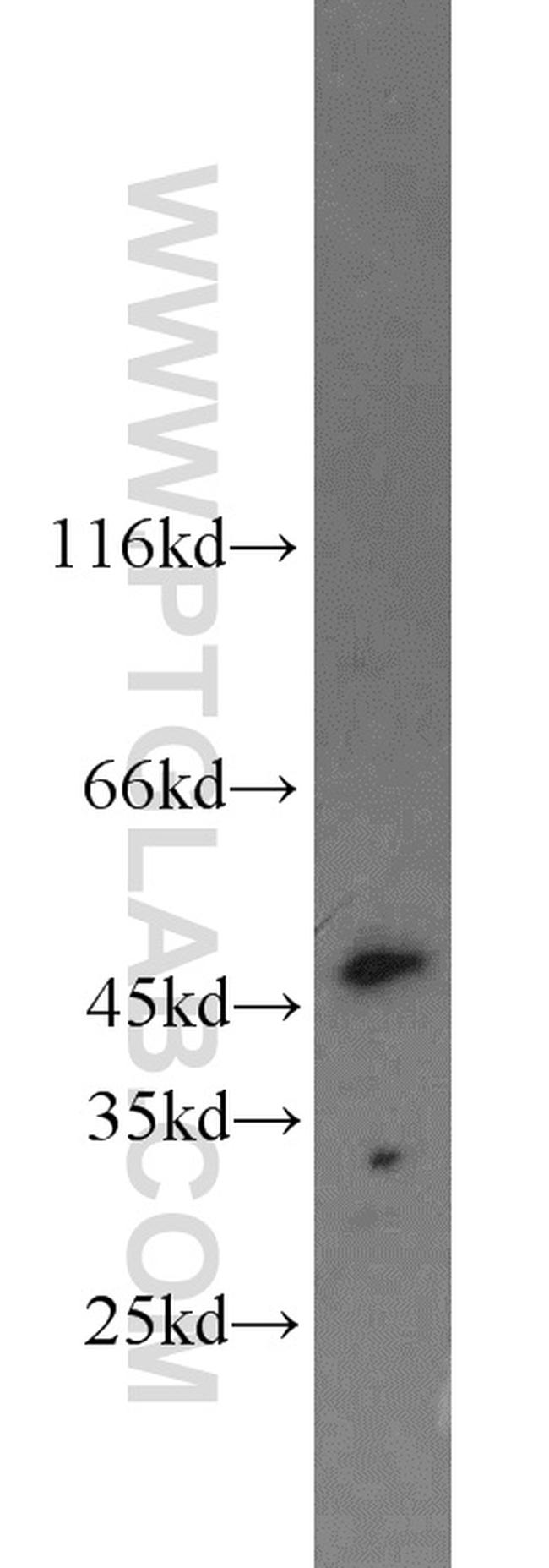 ING3 Antibody in Western Blot (WB)