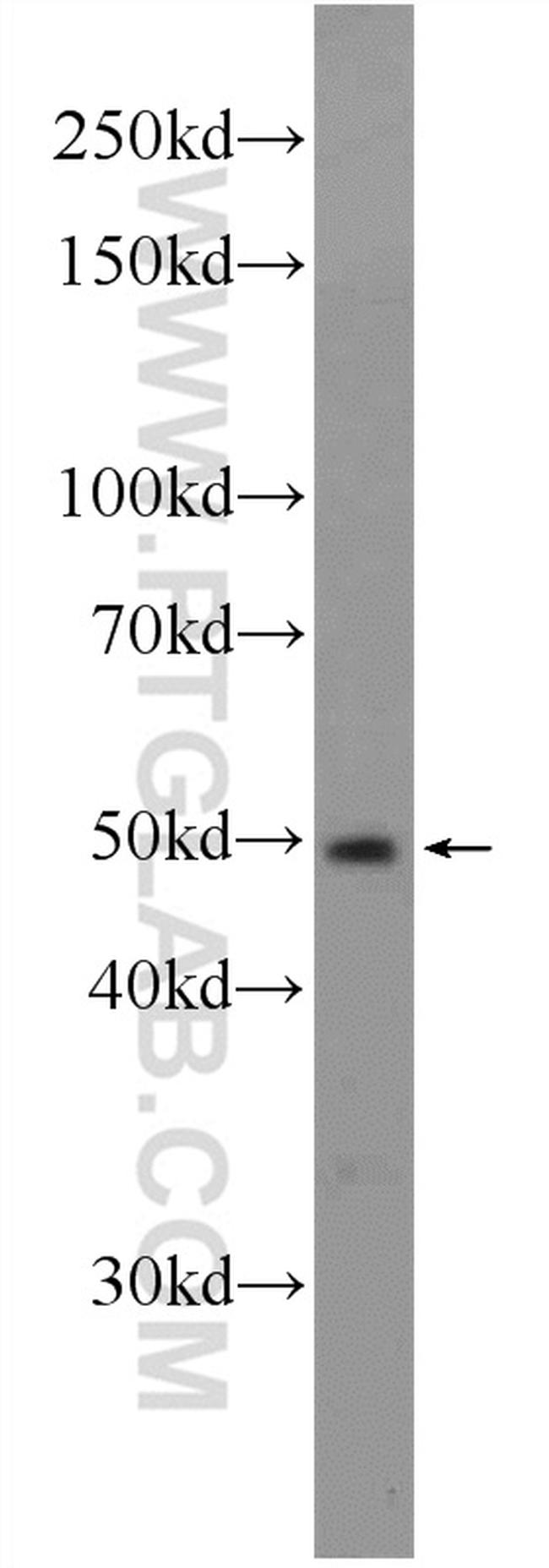 ING3 Antibody in Western Blot (WB)