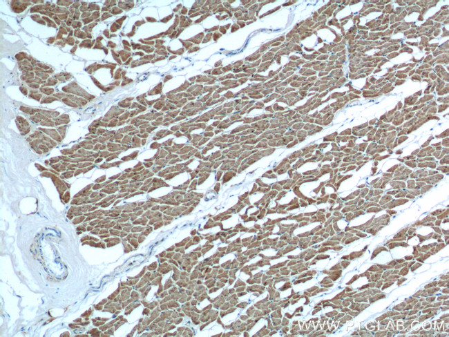 Myosin Light Chain 2 Antibody in Immunohistochemistry (Paraffin) (IHC (P))