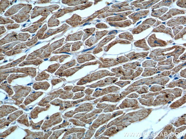 Myosin Light Chain 2 Antibody in Immunohistochemistry (Paraffin) (IHC (P))