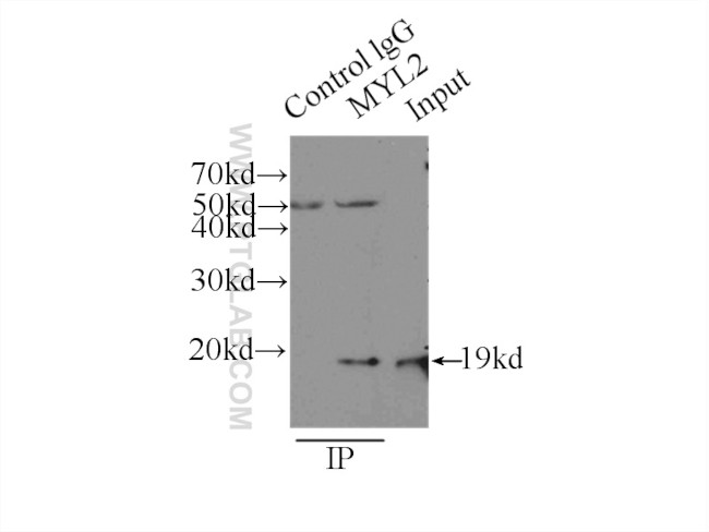 Myosin Light Chain 2 Antibody in Immunoprecipitation (IP)