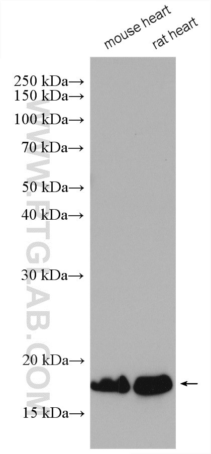 Myosin Light Chain 2 Antibody in Western Blot (WB)