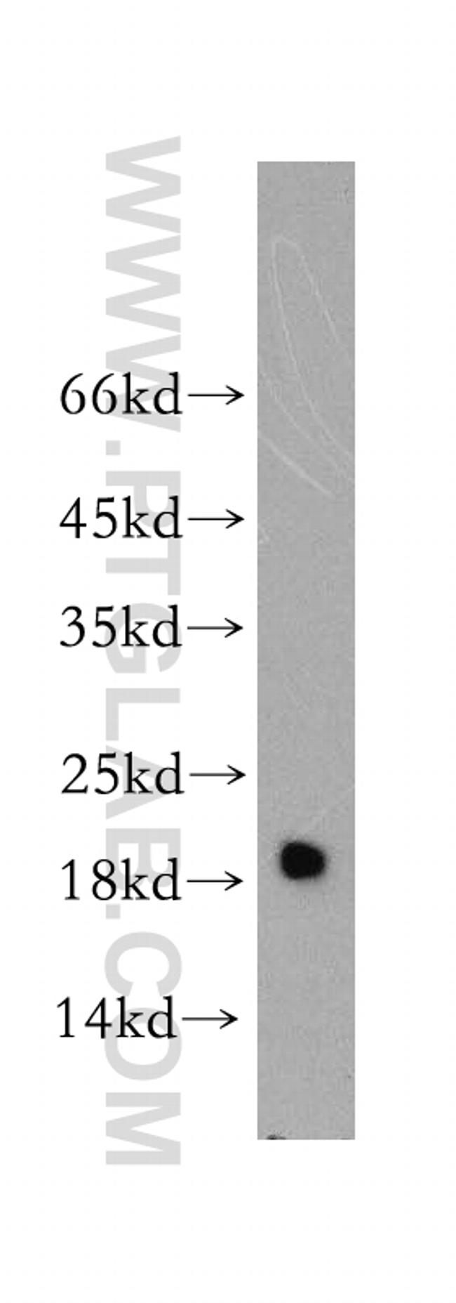 Myosin Light Chain 2 Antibody in Western Blot (WB)