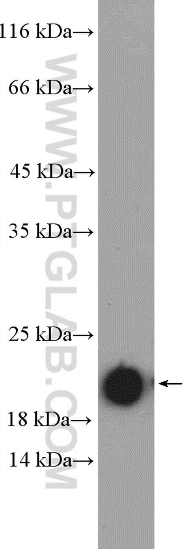 Myosin Light Chain 2 Antibody in Western Blot (WB)