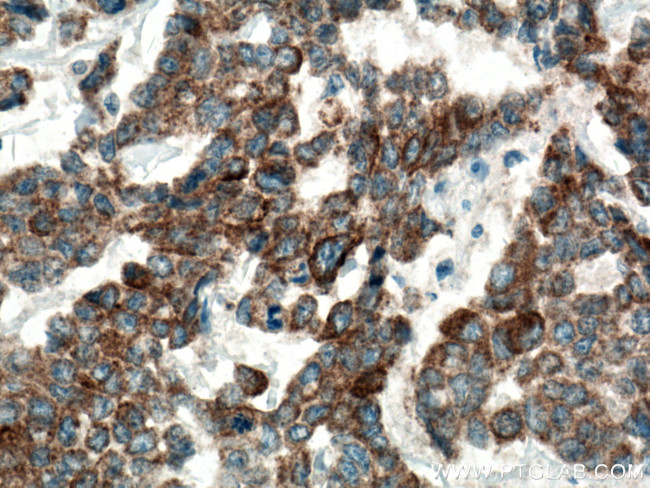 DUSP13 Antibody in Immunohistochemistry (Paraffin) (IHC (P))