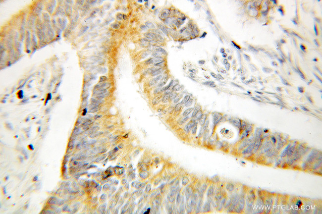 DUSP13 Antibody in Immunohistochemistry (Paraffin) (IHC (P))