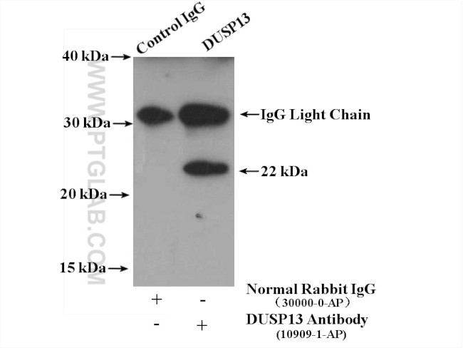 DUSP13 Antibody in Immunoprecipitation (IP)