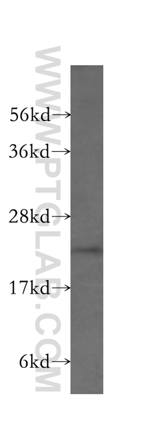 DUSP13 Antibody in Western Blot (WB)