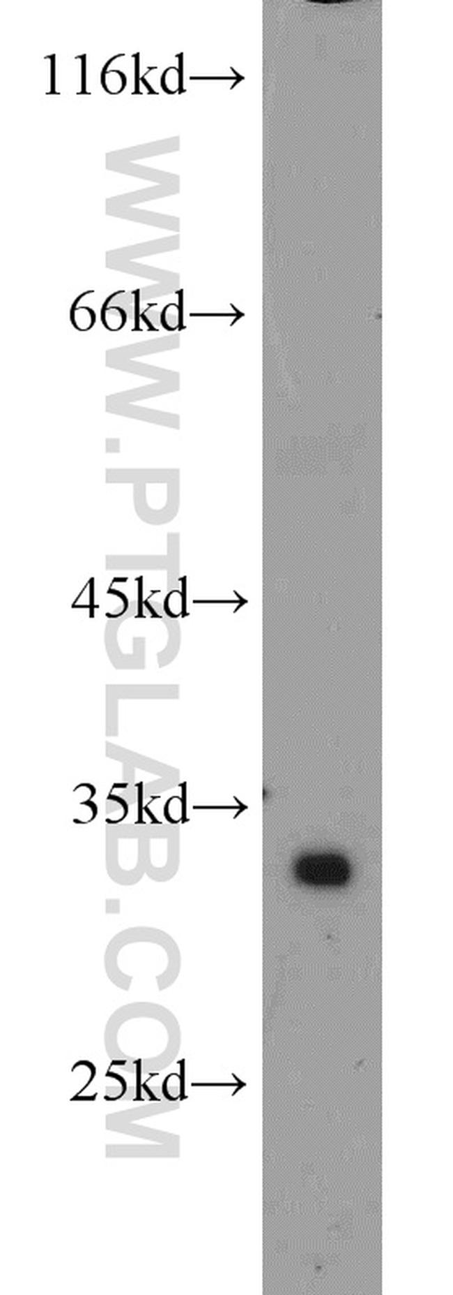 ATP5C1 Antibody in Western Blot (WB)