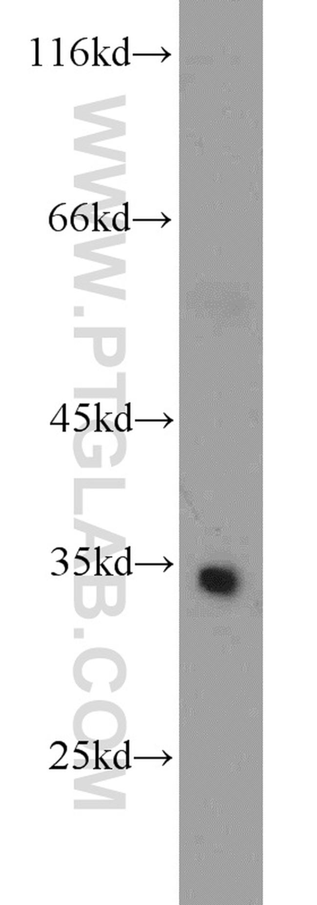 ATP5C1 Antibody in Western Blot (WB)