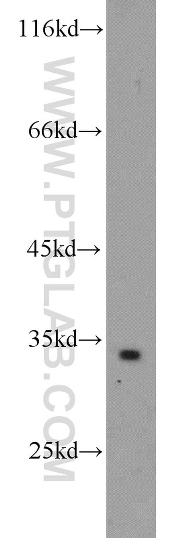 ATP5C1 Antibody in Western Blot (WB)