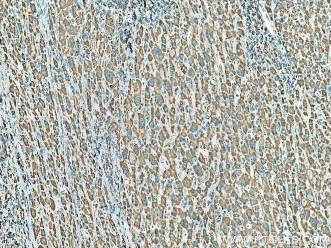 ATP5C1 Antibody in Immunohistochemistry (Paraffin) (IHC (P))