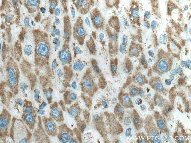 ATP5C1 Antibody in Immunohistochemistry (Paraffin) (IHC (P))