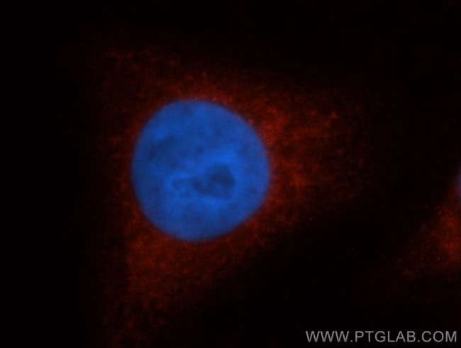 SULT1A1 Antibody in Immunocytochemistry (ICC/IF)