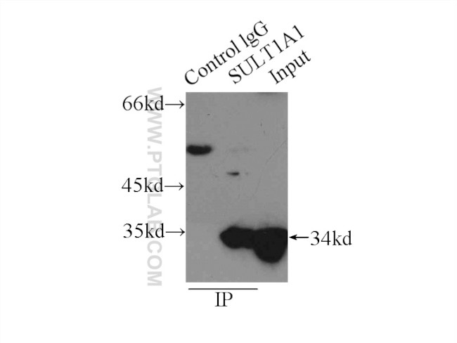 SULT1A1 Antibody in Immunoprecipitation (IP)