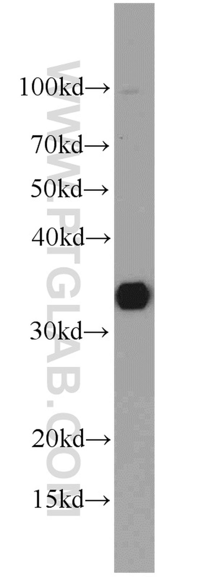 SULT1A1 Antibody in Western Blot (WB)