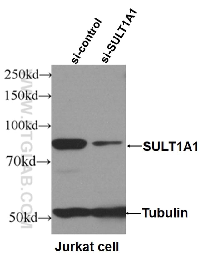 SULT1A1 Antibody in Western Blot (WB)