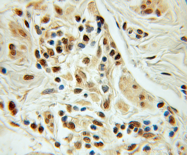 NUDT11 Antibody in Immunohistochemistry (Paraffin) (IHC (P))