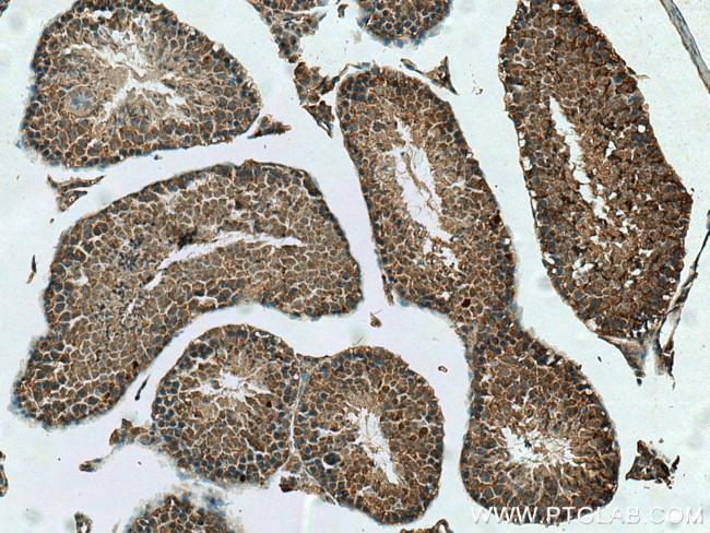 NUDT11 Antibody in Immunohistochemistry (Paraffin) (IHC (P))