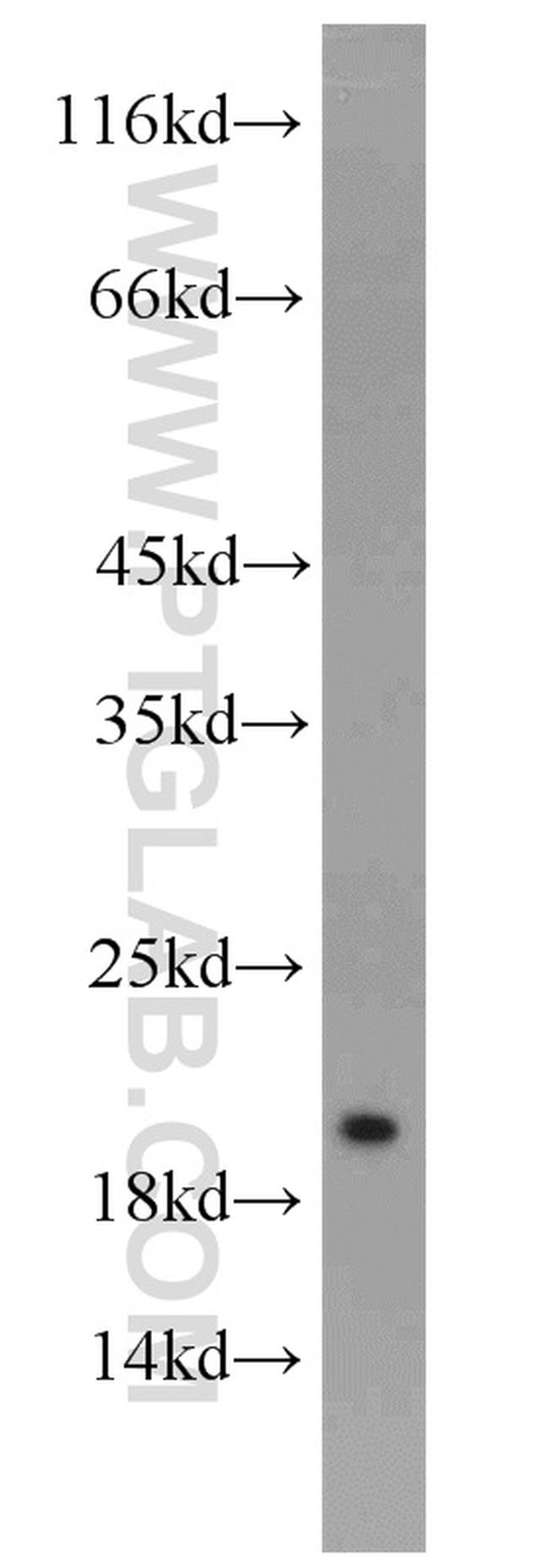 NUDT11 Antibody in Western Blot (WB)