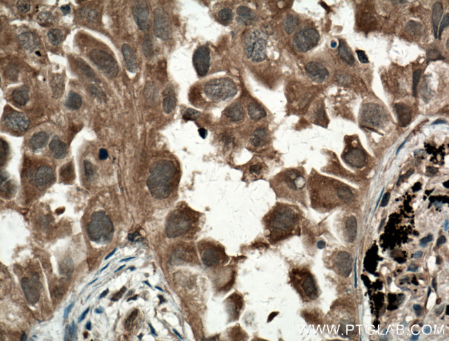 MYL3 Antibody in Immunohistochemistry (Paraffin) (IHC (P))