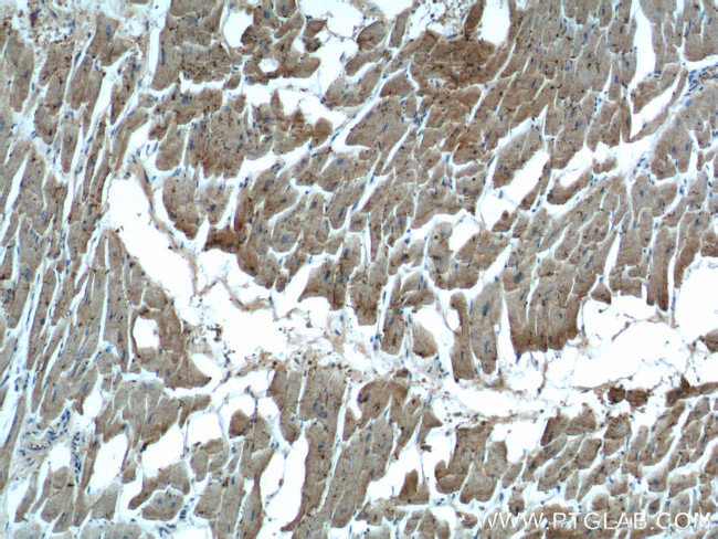 MYL3 Antibody in Immunohistochemistry (Paraffin) (IHC (P))