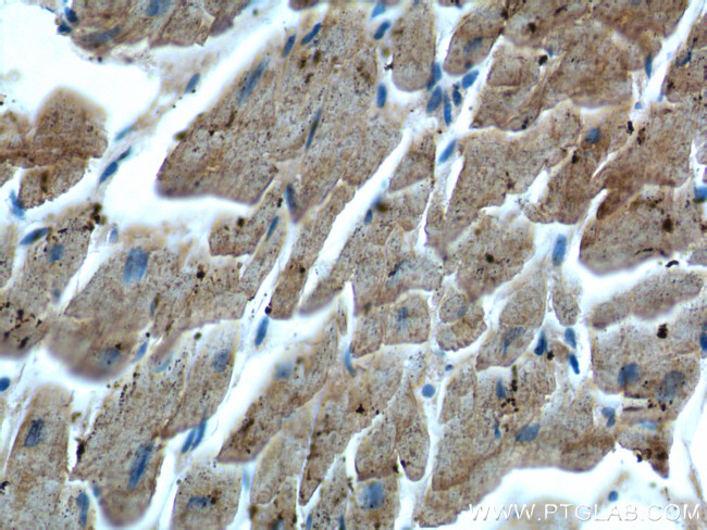 MYL3 Antibody in Immunohistochemistry (Paraffin) (IHC (P))