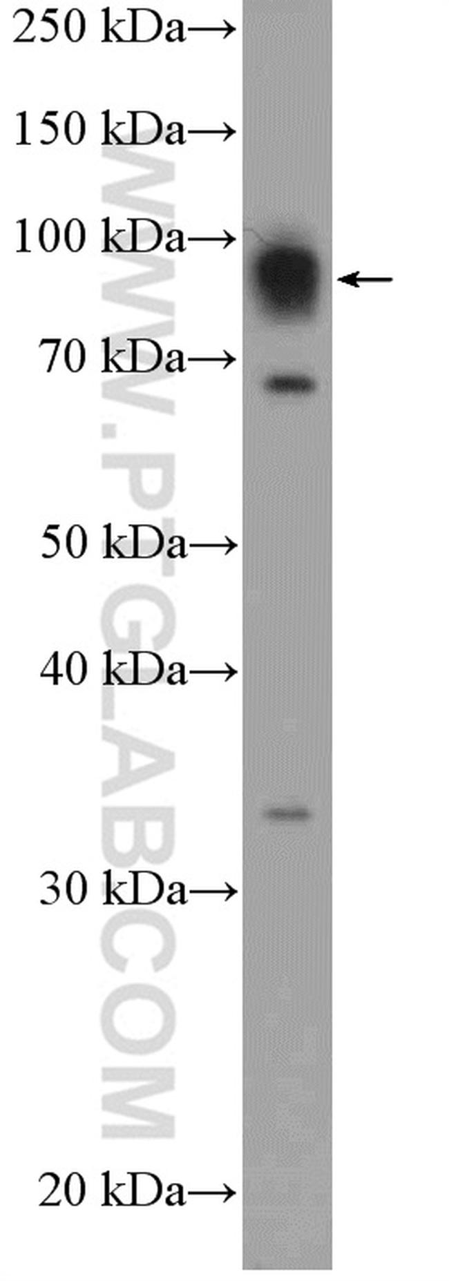 DACH1 Antibody in Western Blot (WB)