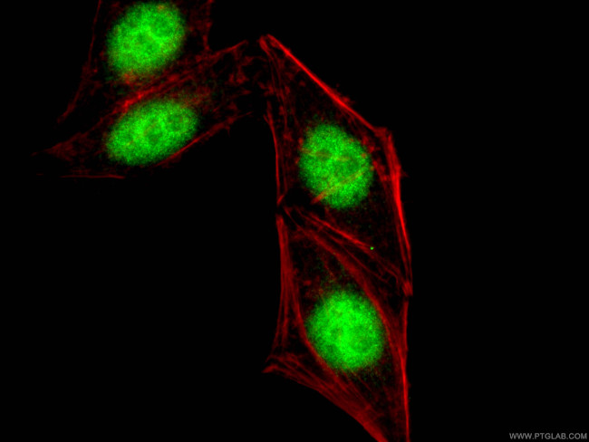 CTCF Antibody in Immunocytochemistry (ICC/IF)