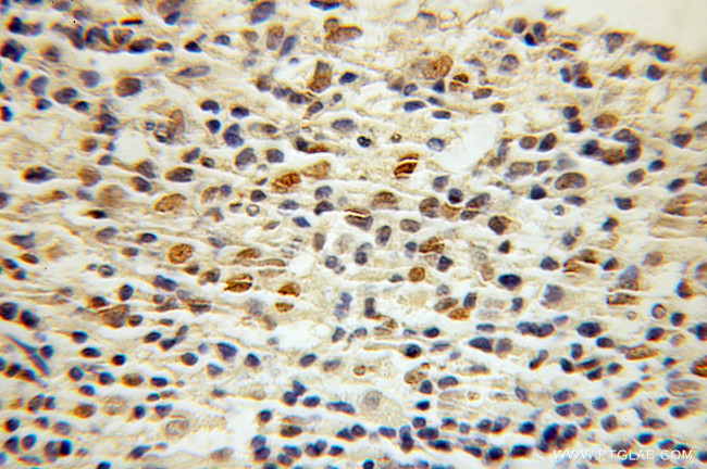 CTCF Antibody in Immunohistochemistry (Paraffin) (IHC (P))