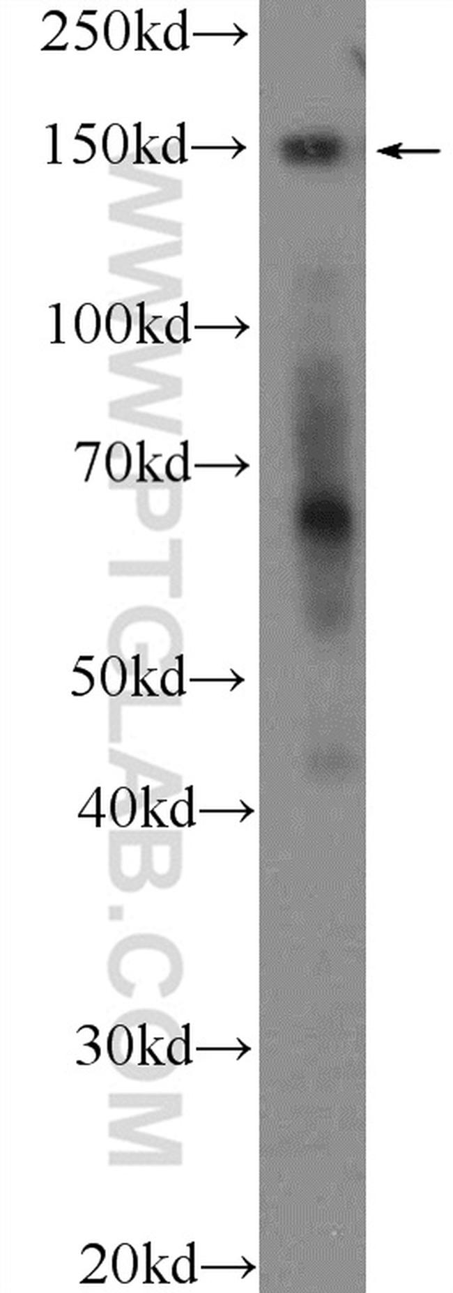 CTCF Antibody in Western Blot (WB)