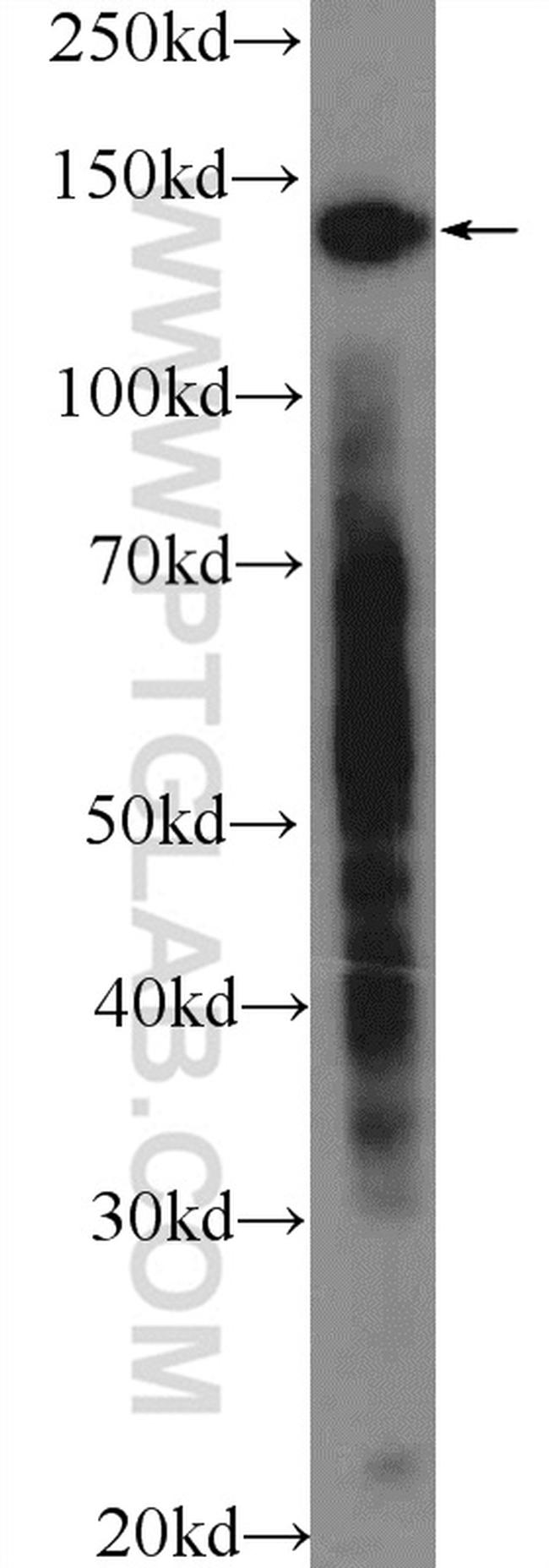 CTCF Antibody in Western Blot (WB)