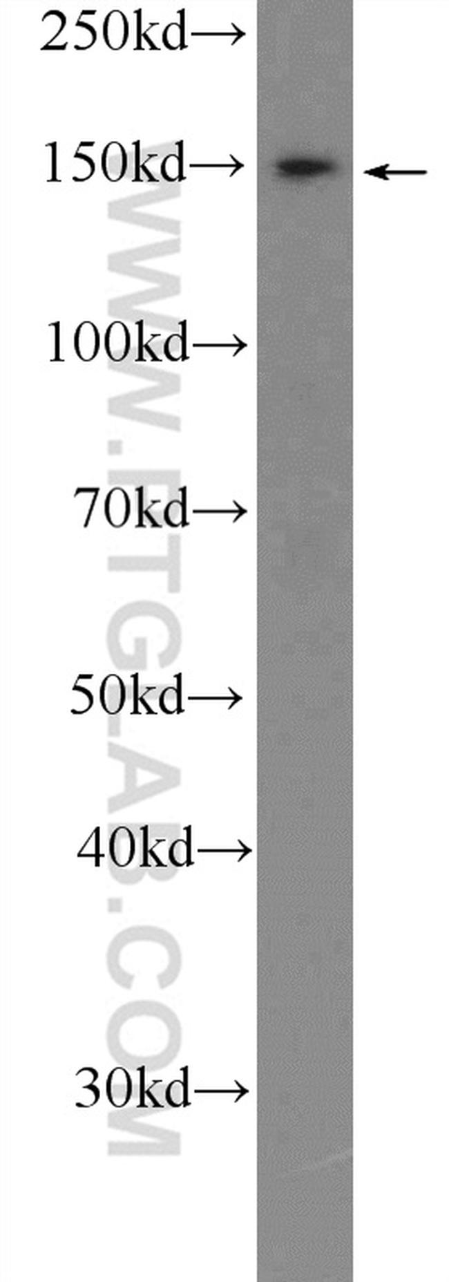 CTCF Antibody in Western Blot (WB)