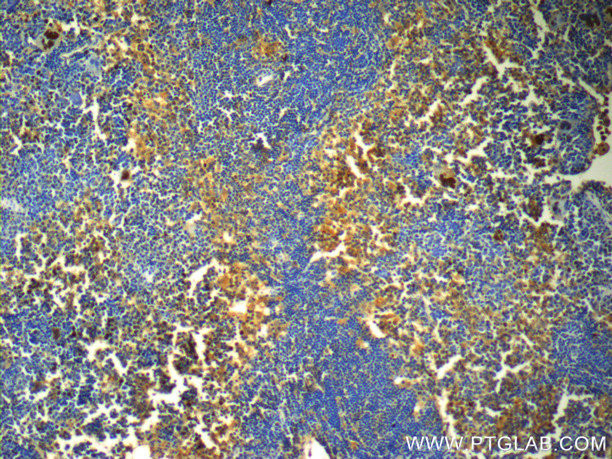 GATA1 Antibody in Immunohistochemistry (Paraffin) (IHC (P))