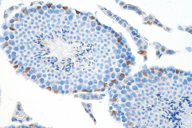 GATA1 Antibody in Immunohistochemistry (Paraffin) (IHC (P))