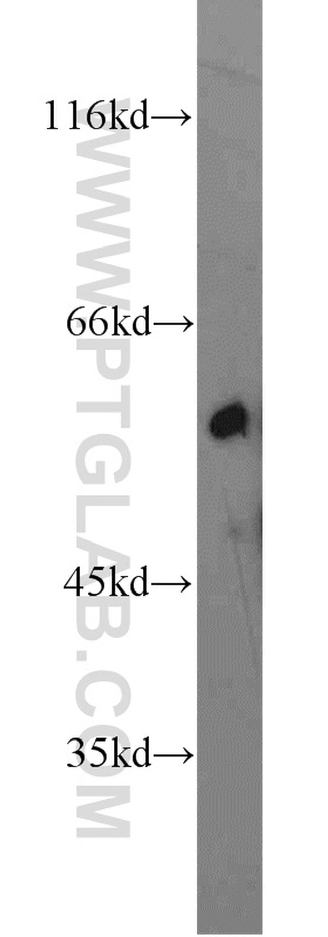 GATA1 Antibody in Western Blot (WB)