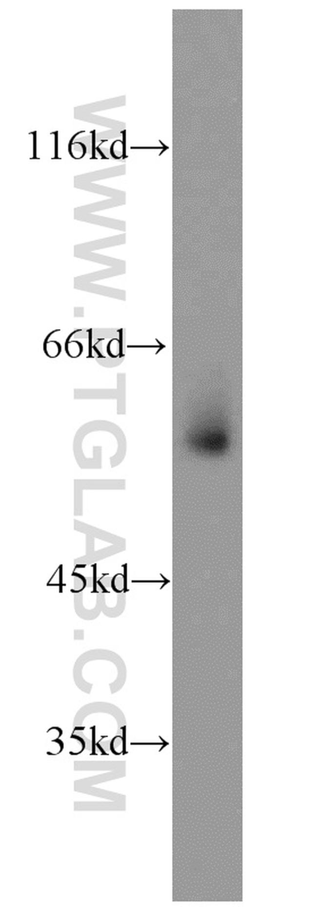 GATA1 Antibody in Western Blot (WB)