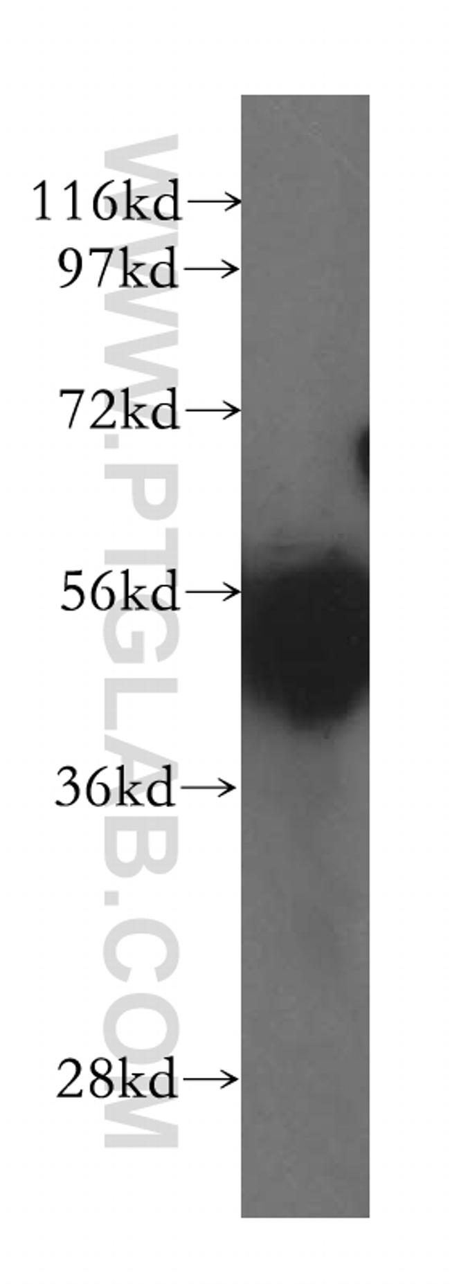 GATA1 Antibody in Western Blot (WB)