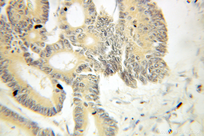 THOC1 Antibody in Immunohistochemistry (Paraffin) (IHC (P))