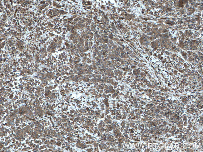 ARP2 Antibody in Immunohistochemistry (Paraffin) (IHC (P))