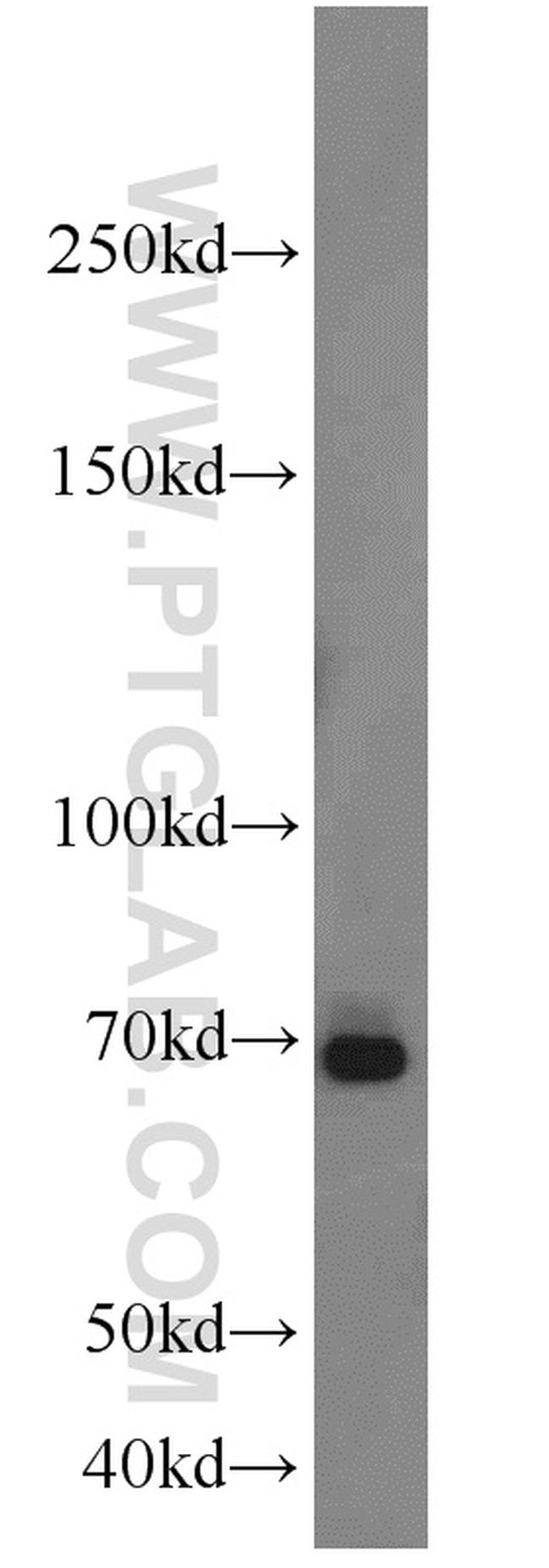 E2F4 Antibody in Western Blot (WB)